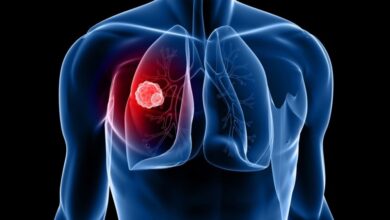 الوقاية من التهاب الشعب الهوائية الحاد: نصائح وتحذيرات