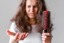 فطريات فروة الرأس: الأعراض والأسباب والعلاج والوقاية