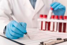 Causes of increased colon cancer in young people: A recent British study