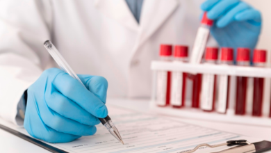 Causes of increased colon cancer in young people: A recent British study