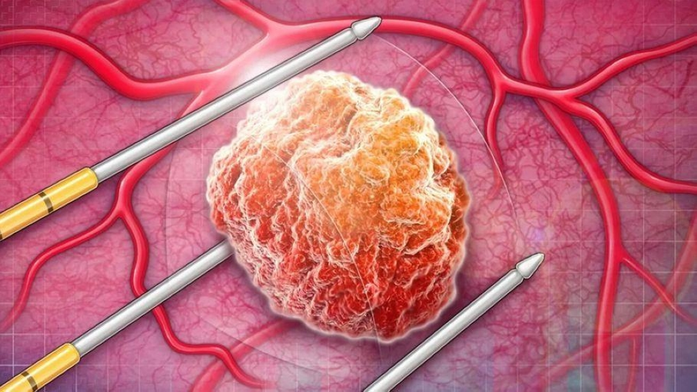 طفرات جينية تعرّض الرجال لخطر السرطان (متداولة)