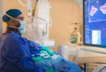 التخصصي بجدة يطلق خدمة تبادل البلازما في العيادات الخارجية