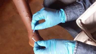 WHO monitors hybrid monkeypox variant: details of cases and risks