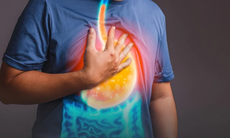 أحدث طرق علاج ارتجاع المريء 2024: الأدوية والجراحة