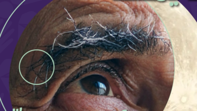 Medical convoy to support 1820 families of Alzheimer's patients in Saudi Arabia