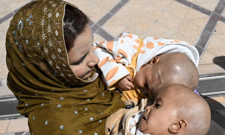 وصول التوأم الباكستاني سفيان ويوسف للرياض لعملية فصل